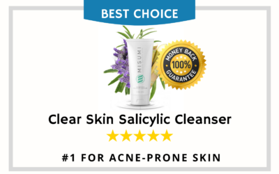 8 Best Acne Face Wash for Oily Skin 2022