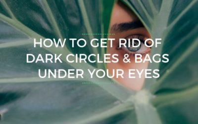 Get Rid of Dark Circles and Bags Under Your Eyes