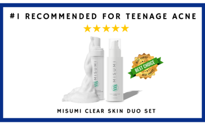 5 Best Acne Treatments for Teens in 2025
